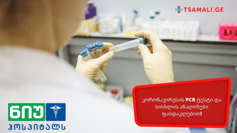აქცია: კორონავირუსის PCR ტესტი და სისხლის ანალიზები ფასდაკლებით!