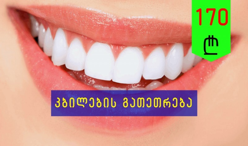 თეთრი კბილები