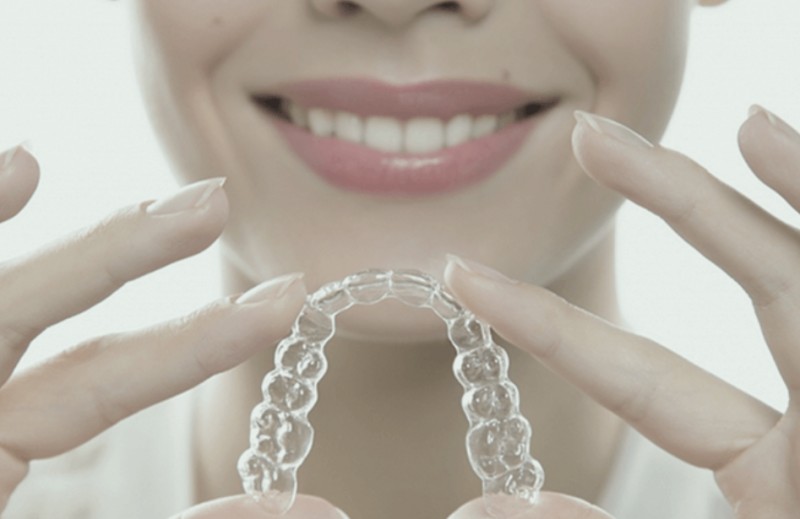 რა ვიცით ბრეკეტებისა და ელაინერების შესახებ?