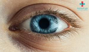 როგორ შევინარჩუნოთ თვალების ჯანმრთელობა - რა იწვევს ზაფხულის კონიუქტივიტს?