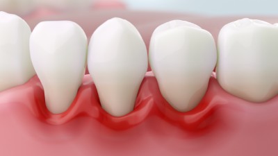 პაროდონტოლოგია 